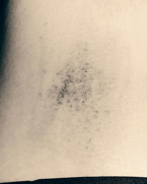 Nass oder trocken epilieren? Der große Vergleich